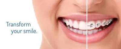 Transform Your Smile