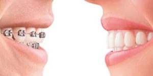 Orthodontics